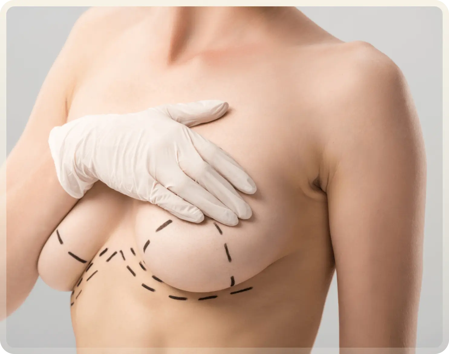 Breast Lift Turkey