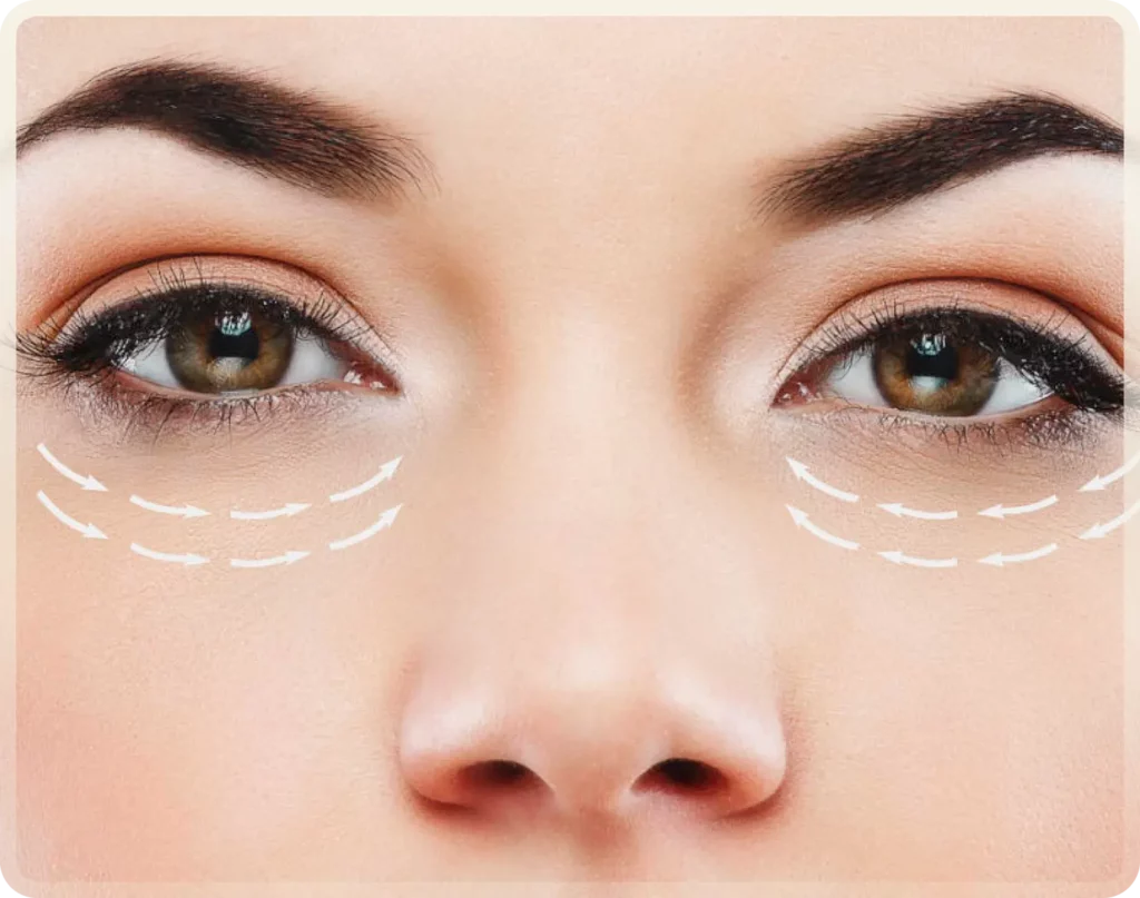 Eyelid Surgery Turkey