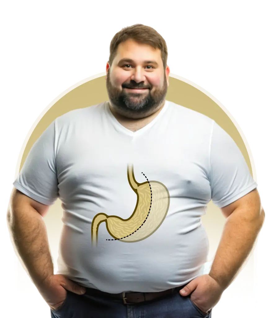 weight loss surgery Turkey