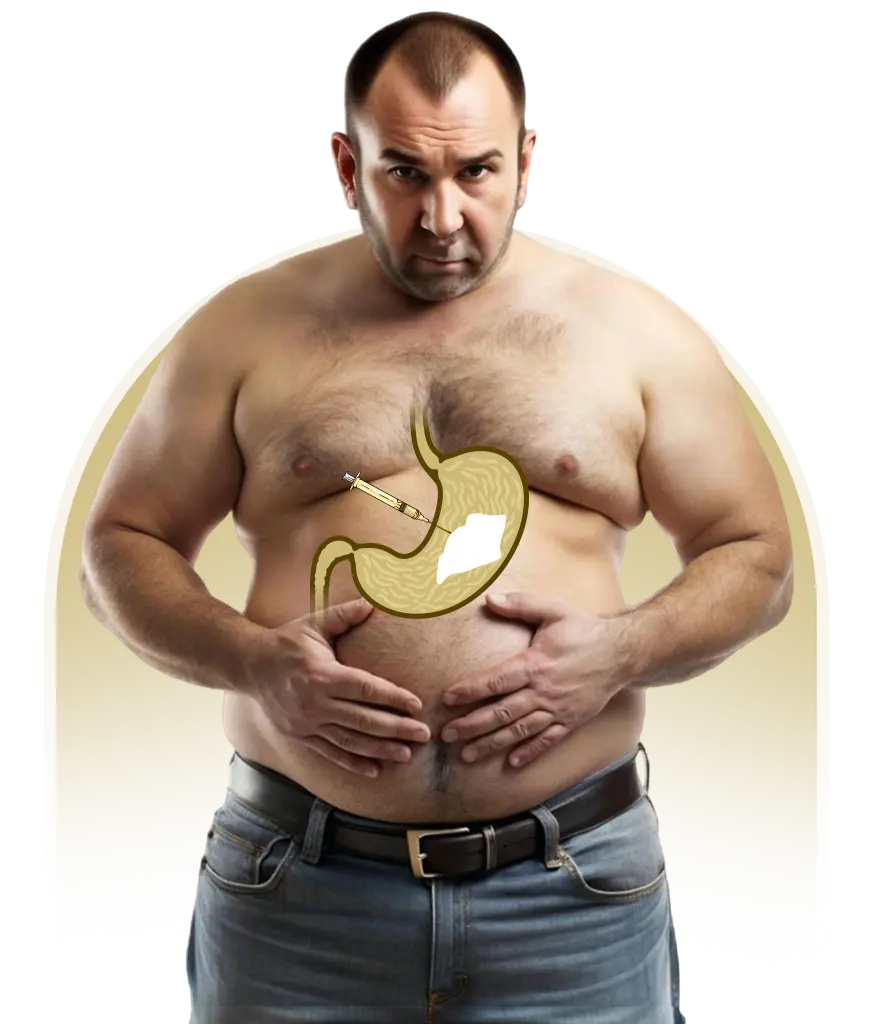 weight loss surgery Turkey