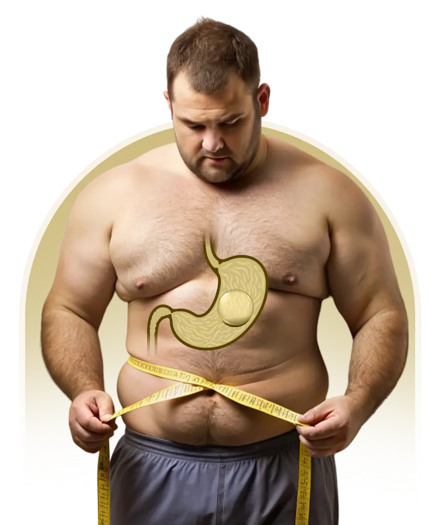 weight loss surgery Turkey
