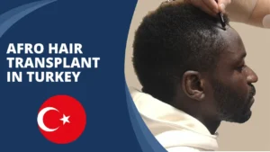 Best Afro Hair Transplant Turkey