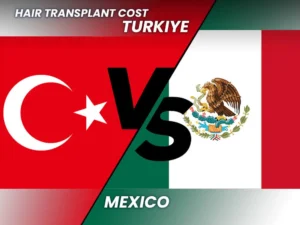 Hair Transplant Mexico vs Turkey