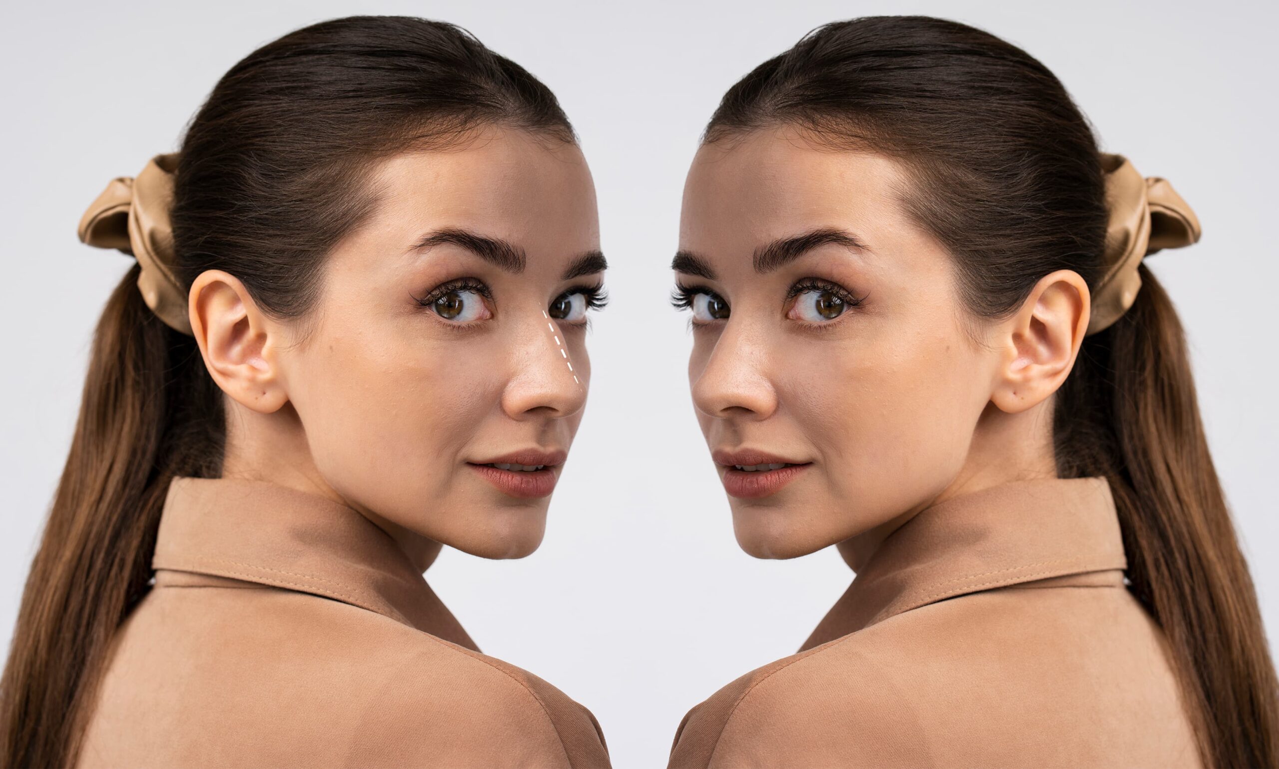 Rhinoplasty in Turkey
