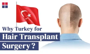 Why Do People Go to Turkey for Hair Transplants