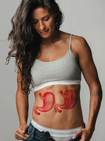 All-Inclusive-gastric-sleeve-turkey-package 2025