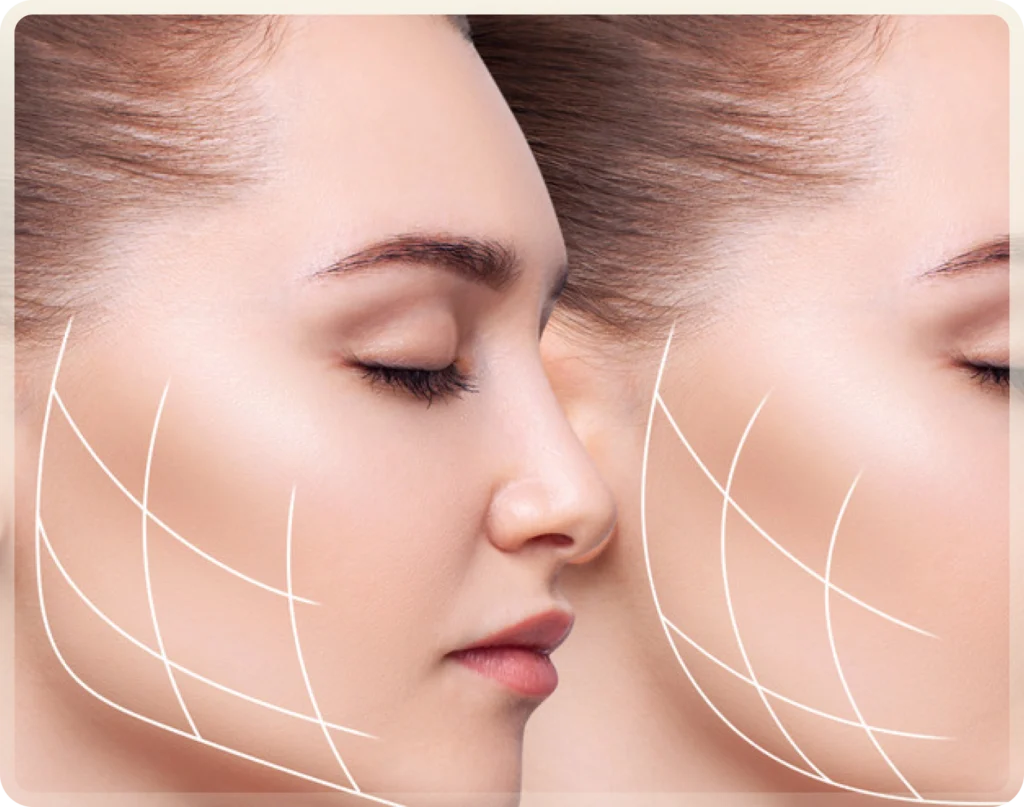 Buccal fat removal Turkey surgery