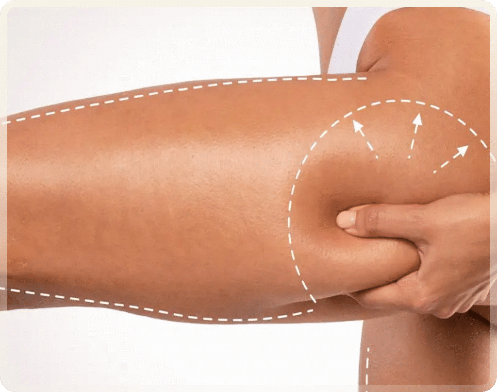 Thigh lift in turkey