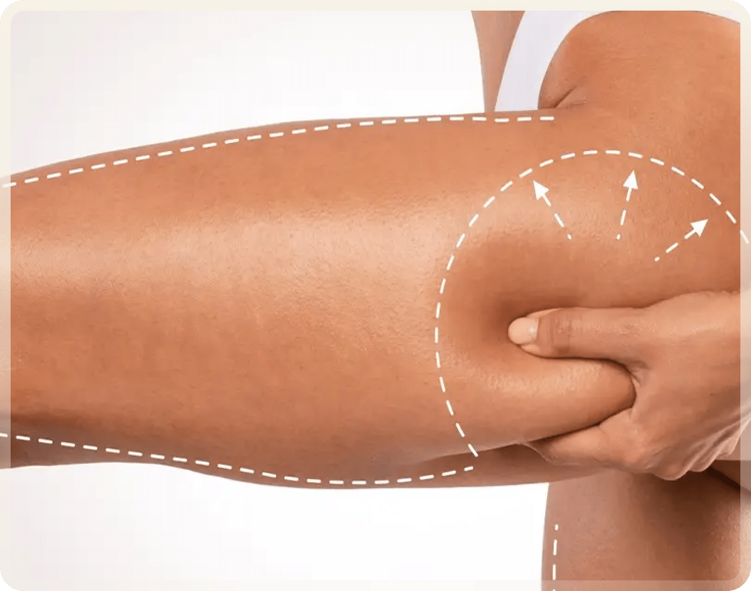 Thigh lift in turkey