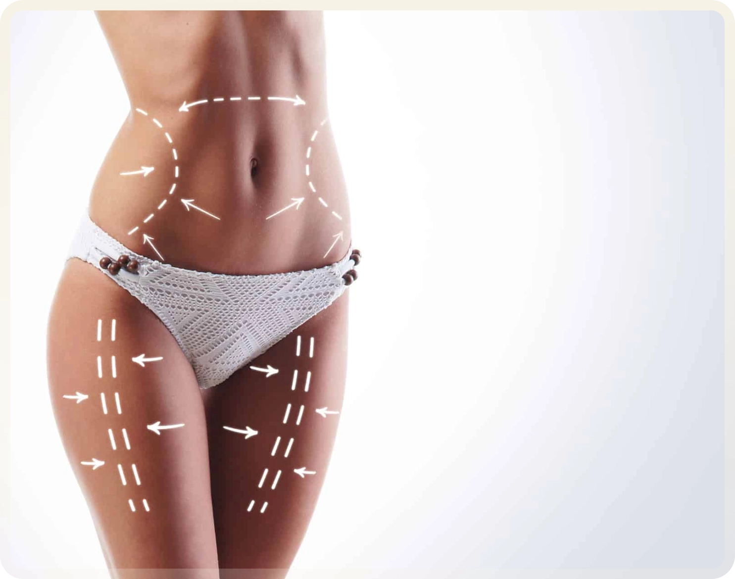 Lipo 360 Turkey - Circumferential liposuction at Carely Clinic Istanbul