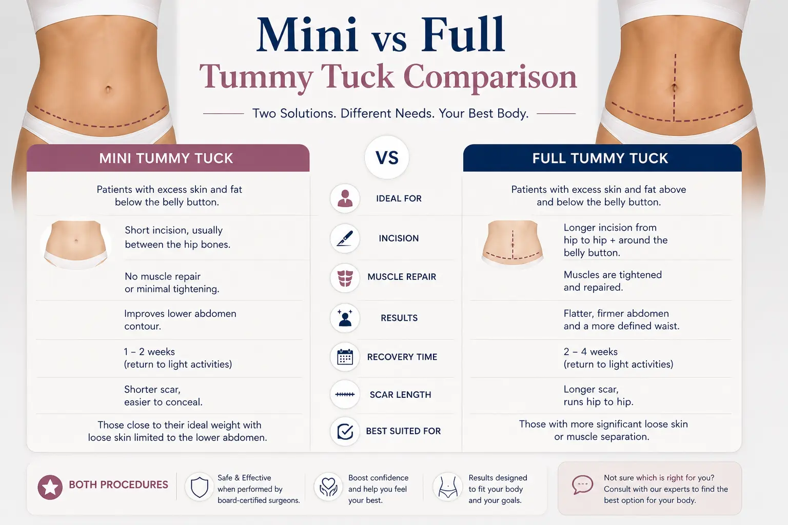 Mini Tummy Tuck vs Full Tummy Tuck full guide